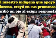 Indigenous teacher from Guerrero lost an eye during clashes between members of the CNTE and security forces